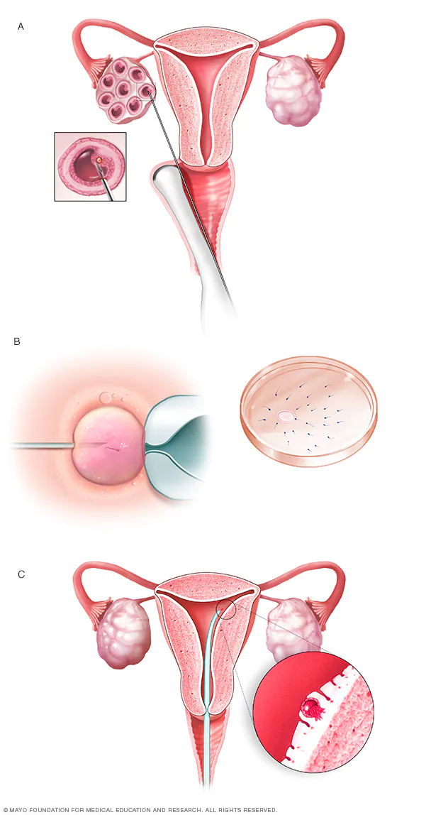 ivf-center (1)